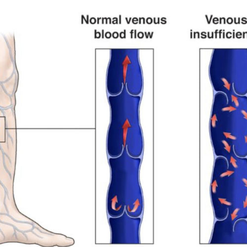 premiercardiovascular