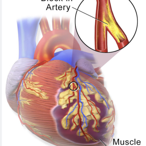 premiercardiovascular