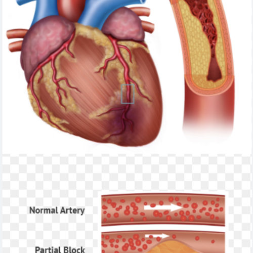 premiercardiovascular