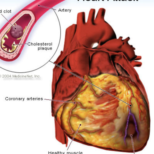 premiercardiovascular