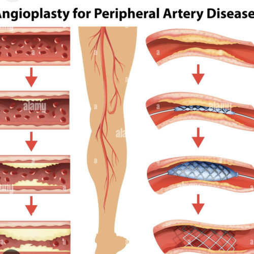 premiercardiovascular