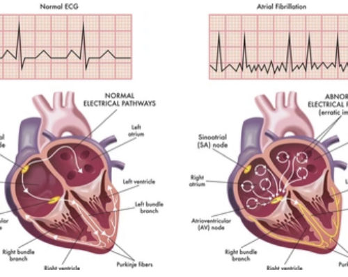 premiercardiovascular