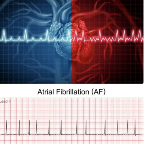 premiercardiovascular